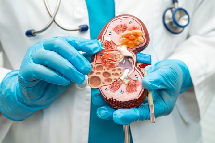 kidney-disease-chronic-kidney-disease-ckd-doctor-2024-01-18-12-03-29-utc (1)