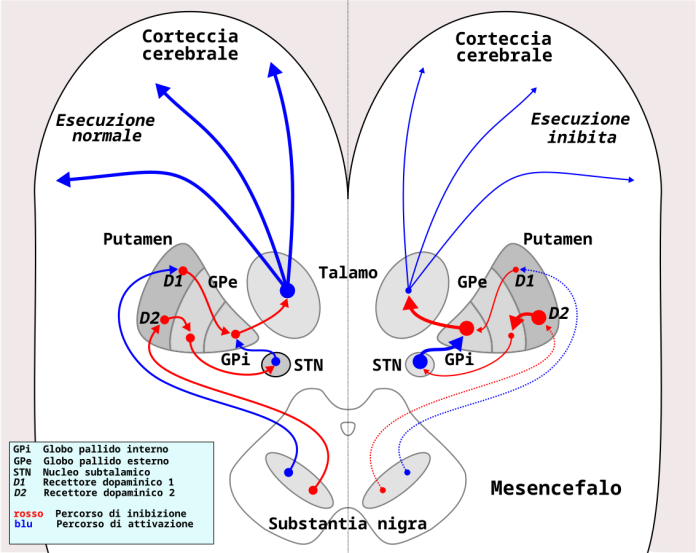 Parkinson