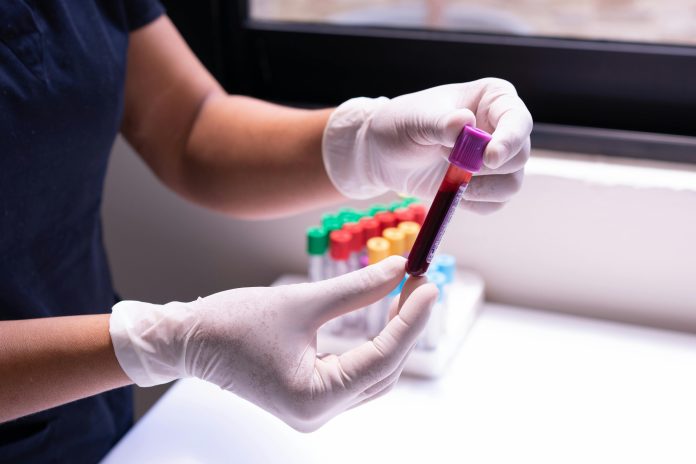L'Aifa decide lo stop al rimborso degli anticorpi contro l'Alzheimer L'Aifa decide lo stop al rimborso degli anticorpi contro l'Alzheimer